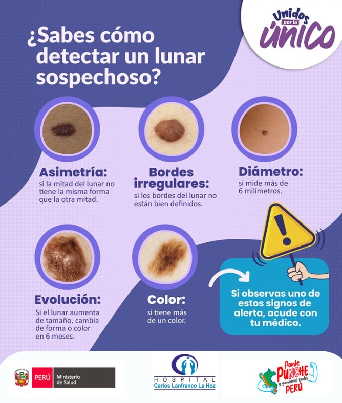 deteccion