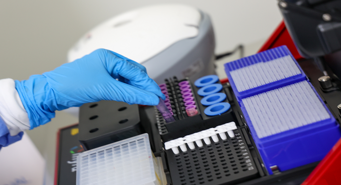 Hospital Rebagliati de EsSalud realiza pruebas moleculares para el diagnóstico de dengue