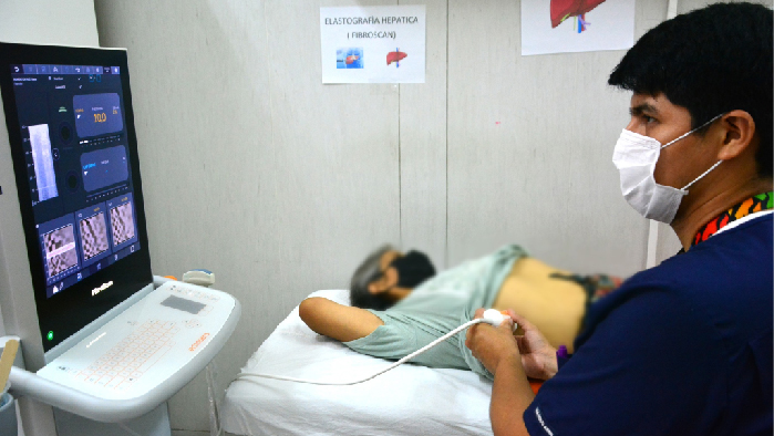 Realizamos elastografías hepáticas en beneficio de pacientes