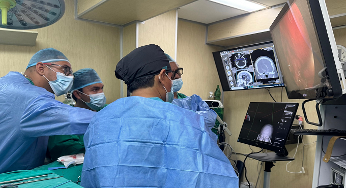 Médicos de EsSalud extirpan raro tumor cerebral por la nariz sin necesidad de cirugía abierta