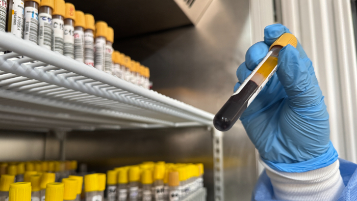 INSN: Servicio de Bioquímica procesa cerca de 31,000 muestras mensuales y ofrece más de 90 tipos de pruebas