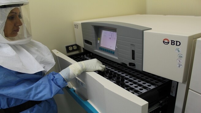 Minsa implementa el diagnóstico molecular de la tuberculosis en Lima y Callao