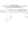 Vista preliminar de documento Resultado Preliminar  Concurso Cas Transitorio N.003-2025-HCH-SBS