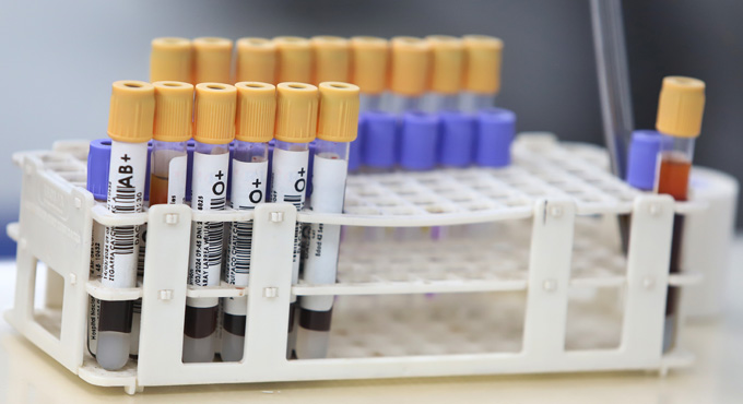 Prueba de laboratorio