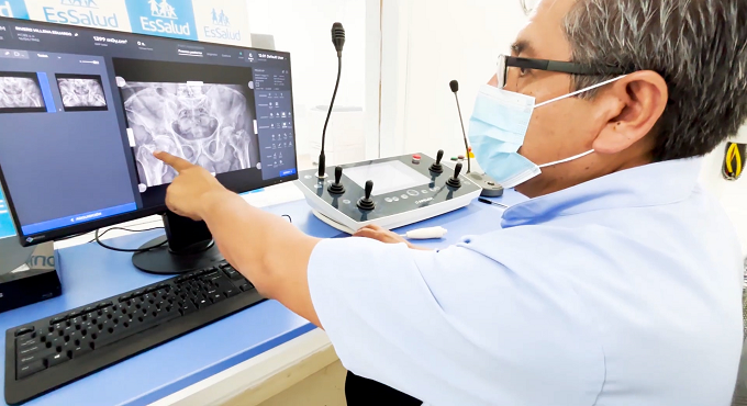 Hospital de Emergencias Grau de EsSalud mejora atención con moderno equipo de radiología digital