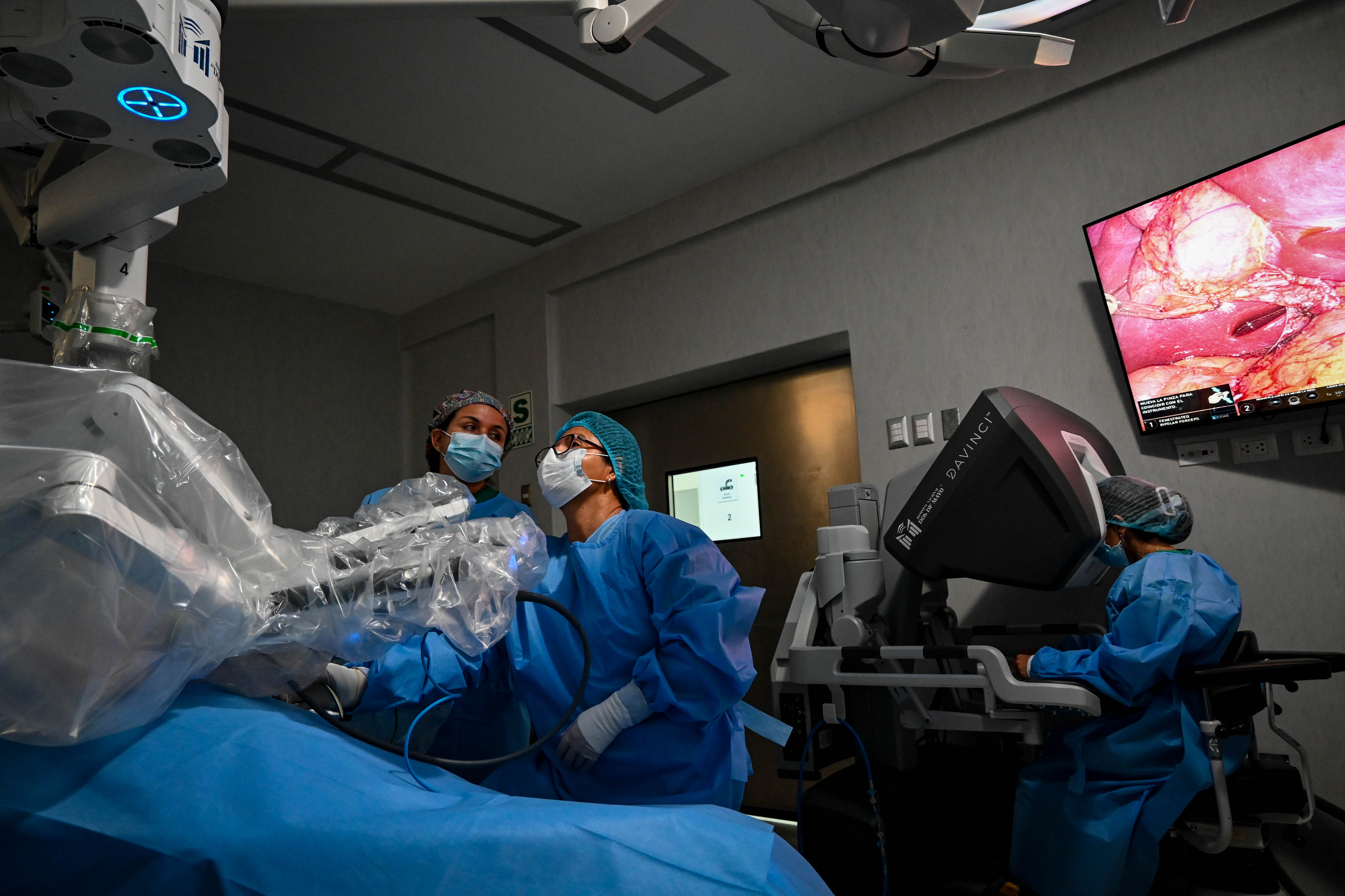 Hospital Dos de Mayo realiza con éxito primeras cirugías robóticas en niños y adolescentes