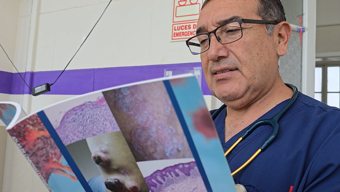El Hospital Nacional Arzobispo Loayza impulsa la investigación médica con la publicación de un atlas pionero sobre linfomas cutáneos