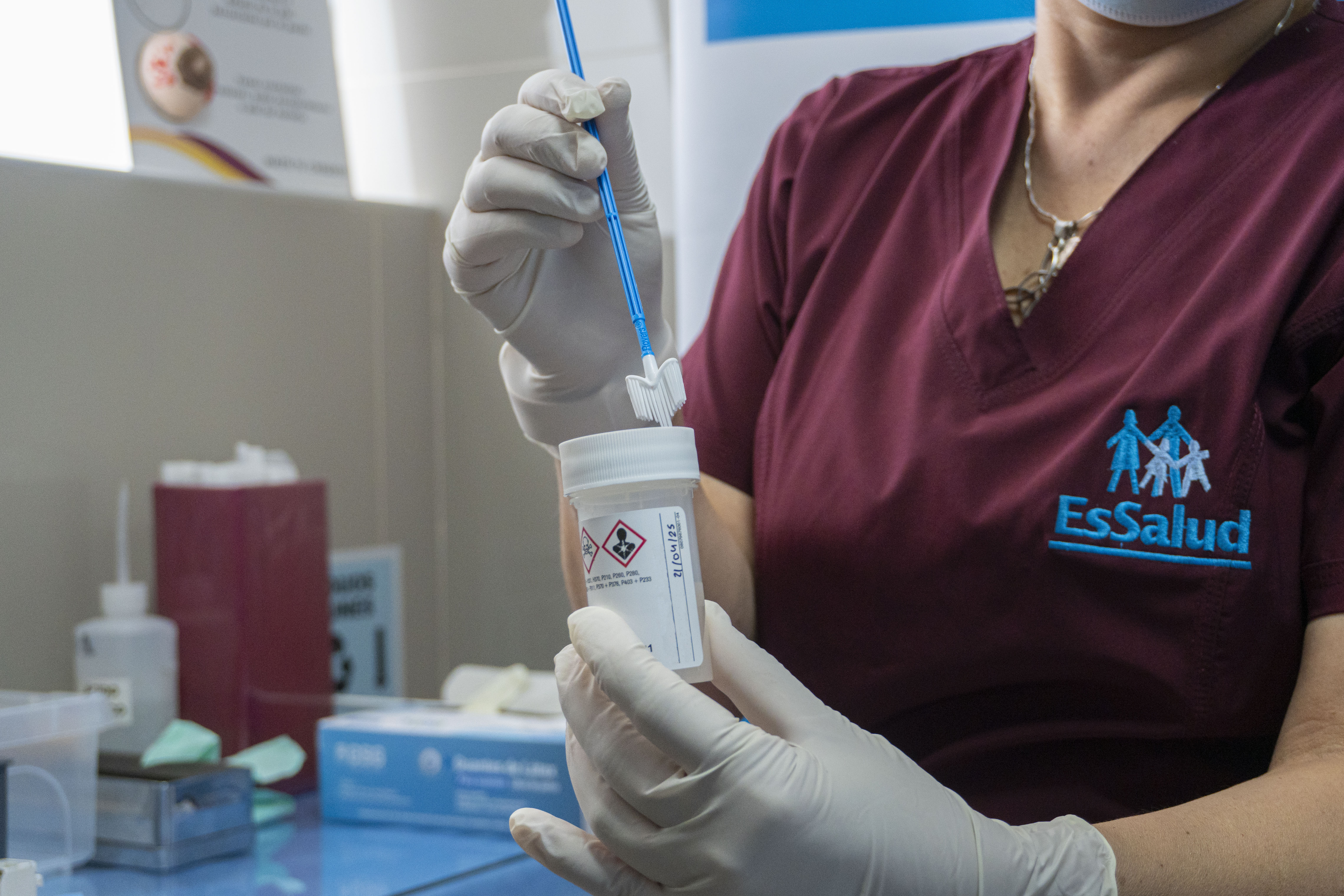EsSalud Sabogal implementa pruebas moleculares para prevenir el cáncer de cuello uterino