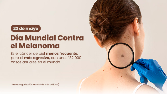 FOTO4