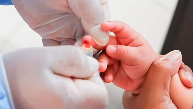Más de 28 mil niños menores de 3 años recibieron atención nutricional en consultorios de la Diris Lima Centro para prevenir anemia infantil 3