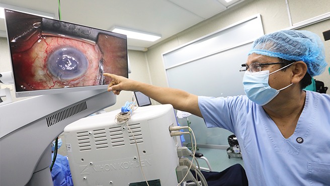 Minsa fortalece el equipamiento médico del INO con la entrega de modernos microscopios quirúrgicos para cirugías oculares