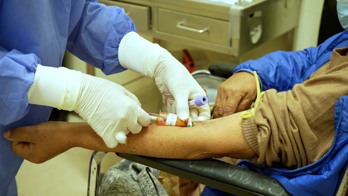 EsSalud llama a prevenir la hepatitis crónica B y C que es la causa del 40% de casos de cirrosis hepática
