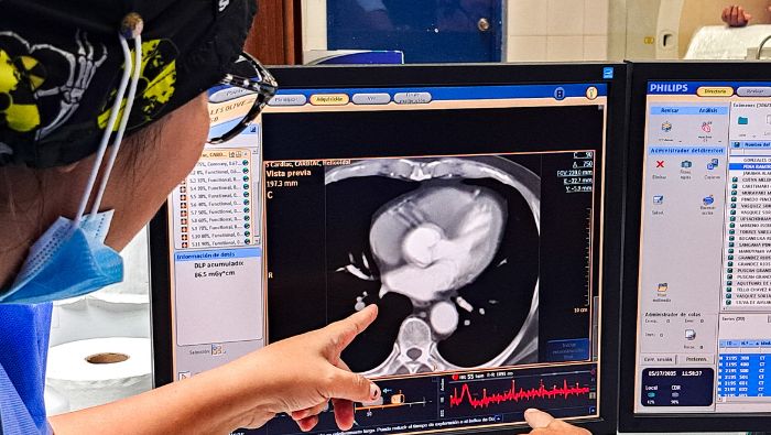 INCOR de EsSalud acerca atención cardiológica especializada a asegurados de Iquitos