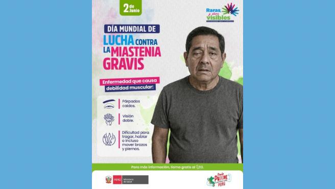 ¿Tienes debilidad muscular? Podría ser miastenia gravis: una enfermedad poco común