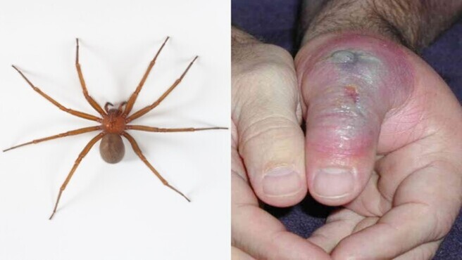 INS advierte aumento de mordeduras de araña casera durante el invierno