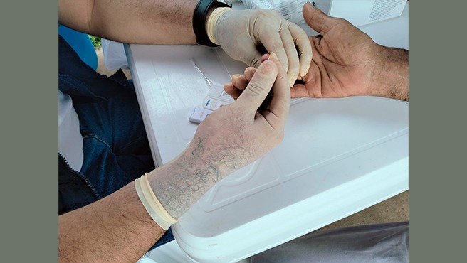 Día Nacional de la Lucha contra la Hepatitis B: Minsa realizará tamizajes y vacunación a nivel nacional